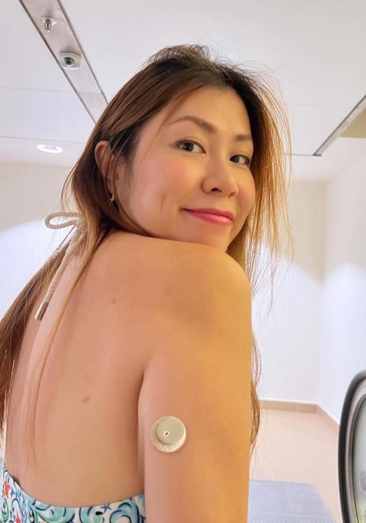May wearing a CGM sensor on her upper arm